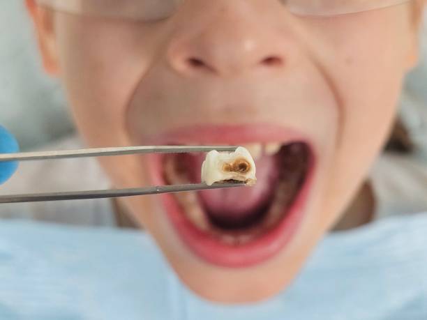 Best Broken Tooth Emergency  in Great Bend, KS